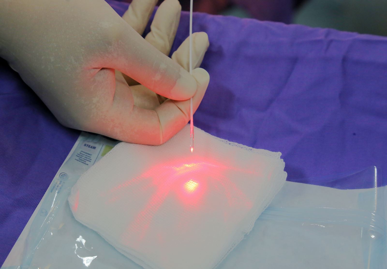 Khám trĩ bằng công nghệ laser là gì?